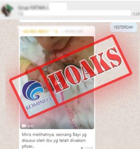 (Hoaks) Balita Menyusui Ibu Yang Vaksin Pfizer, Itu Berbahaya !