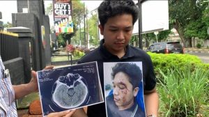 Anak Kasat Narkoba Polresta Deli Serdang Dilaporkan Ke Denpom 1/5 Medan Usai Aniaya Mahasiswa UISU