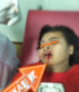 Sadis, Niat Nagih Hutang, RY Dibacok Teman Kerja